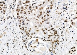 Invitrogen UBA2 Polyclonal Antibody 100 &mu;L; Unconjugated:Antibodies,