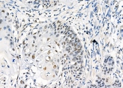 Invitrogen UBA2 Polyclonal Antibody 100 &mu;L; Unconjugated:Antibodies,