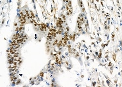 Invitrogen UBA2 Polyclonal Antibody 100 &mu;L; Unconjugated:Antibodies,