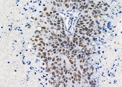 Invitrogen UBA2 Polyclonal Antibody 100 &mu;L; Unconjugated:Antibodies,