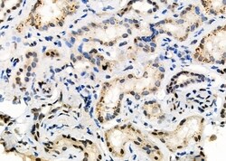 Invitrogen UBA2 Polyclonal Antibody 100 &mu;L; Unconjugated:Antibodies,