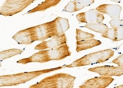 Invitrogen Urocortin Polyclonal Antibody 100 &mu;L; Unconjugated:Antibodies,