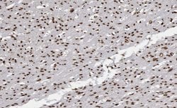 Invitrogen USF2 Polyclonal Antibody 100 &mu;L | Buy Online | Invitrogen&trade; | Fisher Scientific