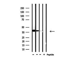 Invitrogen USF2 Polyclonal Antibody 100 &mu;L | Buy Online | Invitrogen&trade; | Fisher Scientific