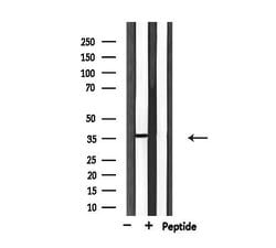 Invitrogen USF2 Polyclonal Antibody 100 &mu;L | Buy Online | Invitrogen&trade; | Fisher Scientific