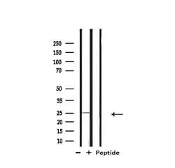 RPL10 Polyclonal Antibody:Antibodies, Polyclonal