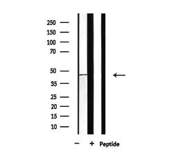Invitrogen BCKDK Polyclonal Antibody 100 &mu;L; Unconjugated:Antibodies,