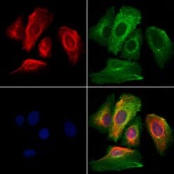 LIGHT Polyclonal Antibody:Antibodies, Polyclonal