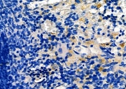 LIGHT Polyclonal Antibody:Antibodies, Polyclonal