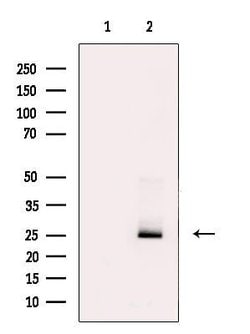 LIGHT Polyclonal Antibody:Antibodies, Polyclonal