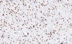 Invitrogen DLX3 Polyclonal Antibody 100 &mu;L; Unconjugated:Antibodies,