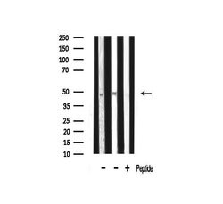 Invitrogen TADA2L Polyclonal Antibody 100 &mu;L; Unconjugated:Antibodies,