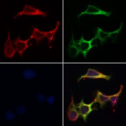 Invitrogen KIP2 Polyclonal Antibody 100 &mu;L; Unconjugated:Antibodies,