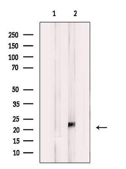 Invitrogen KIP2 Polyclonal Antibody 100 &mu;L; Unconjugated:Antibodies,
