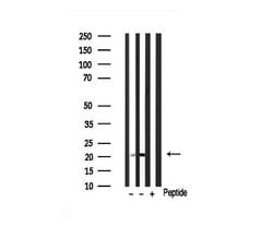 Invitrogen KIP2 Polyclonal Antibody 100 &mu;L; Unconjugated:Antibodies,