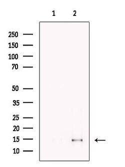 Invitrogen CDK2AP2 Polyclonal Antibody 100 &mu;L; Unconjugated:Antibodies,