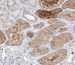 Invitrogen TRIM16 Polyclonal Antibody 100 &mu;L; Unconjugated:Antibodies,