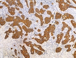 Invitrogen TRIM16 Polyclonal Antibody 100 &mu;L; Unconjugated:Antibodies,