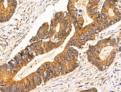 Invitrogen TRIM16 Polyclonal Antibody 100 &mu;L; Unconjugated:Antibodies,