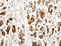 Invitrogen TRIM16 Polyclonal Antibody 100 &mu;L; Unconjugated:Antibodies,