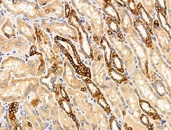 Invitrogen TRIM16 Polyclonal Antibody 100 &mu;L; Unconjugated:Antibodies,