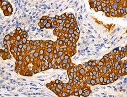 Invitrogen TRIM16 Polyclonal Antibody 100 &mu;L; Unconjugated:Antibodies,