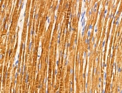 Invitrogen TRIM16 Polyclonal Antibody 100 &mu;L; Unconjugated:Antibodies,