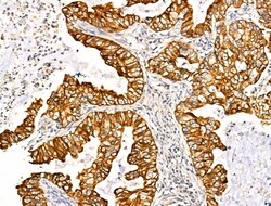 Invitrogen TRIM16 Polyclonal Antibody 100 &mu;L; Unconjugated:Antibodies,