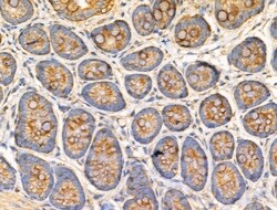 Invitrogen TRIM16 Polyclonal Antibody 100 &mu;L; Unconjugated:Antibodies,