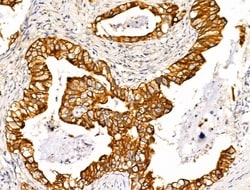 Invitrogen TRIM16 Polyclonal Antibody 100 &mu;L; Unconjugated:Antibodies,