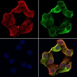 Invitrogen TAP Polyclonal Antibody 100 &mu;L; Unconjugated:Antibodies,