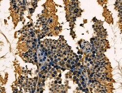 Invitrogen TAP Polyclonal Antibody 100 &mu;L; Unconjugated:Antibodies,