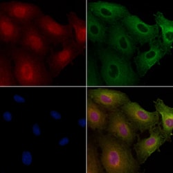 DMC1 Polyclonal Antibody:Antibodies, Polyclonal
