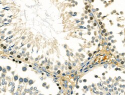 DMC1 Polyclonal Antibody:Antibodies, Polyclonal
