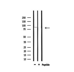 DMC1 Polyclonal Antibody:Antibodies, Polyclonal