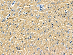 RPS9 Polyclonal Antibody:Antibodies, Polyclonal