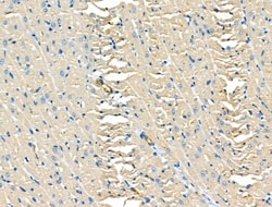 Invitrogen FYCO1 Polyclonal Antibody 100 &mu;L; Unconjugated:Antibodies,