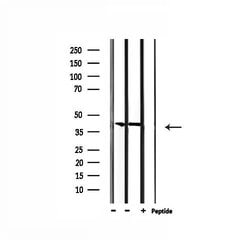 Invitrogen CBX6 Polyclonal Antibody 100 &mu;L; Unconjugated:Antibodies,