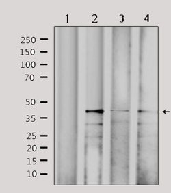 Invitrogen CBX6 Polyclonal Antibody 100 &mu;L; Unconjugated:Antibodies,