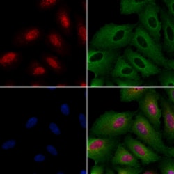 ATRX Polyclonal Antibody:Antibodies, Polyclonal