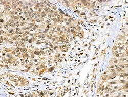 ATRX Polyclonal Antibody:Antibodies, Polyclonal