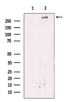 ATRX Polyclonal Antibody:Antibodies, Polyclonal