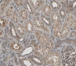 Invitrogen DUS2L Polyclonal Antibody 100 &mu;L; Unconjugated:Antibodies,