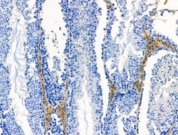 Invitrogen DUS2L Polyclonal Antibody 100 &mu;L; Unconjugated:Antibodies,