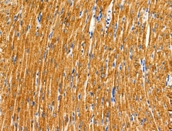 Invitrogen DUS2L Polyclonal Antibody 100 &mu;L; Unconjugated:Antibodies,