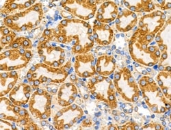 Invitrogen DUS2L Polyclonal Antibody 100 &mu;L; Unconjugated:Antibodies,