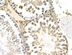 Invitrogen DUS2L Polyclonal Antibody 100 &mu;L; Unconjugated:Antibodies,