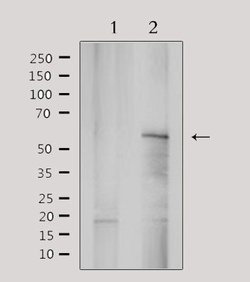 Invitrogen YTHDF1 Polyclonal Antibody 100 &mu;L; Unconjugated:Antibodies,