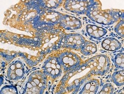 Invitrogen EPS8L2 Polyclonal Antibody 100 &mu;L | Buy Online | Invitrogen&trade; | Fisher Scientific