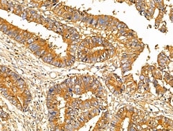 Invitrogen MUC13 Polyclonal Antibody 100 &mu;L; Unconjugated:Antibodies,
